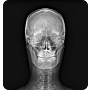 OTOM Portable Handheld X-Ray