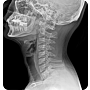 OTOM Portable Handheld X-Ray