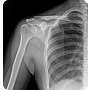 OTOM Portable Handheld X-Ray