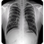 OTOM Portable Handheld X-Ray