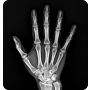 OTOM Portable Handheld X-Ray